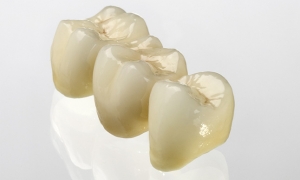 Cerec