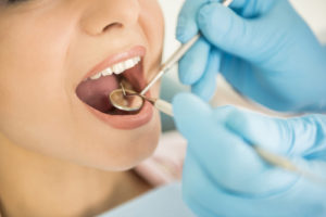 Transport der Zähne nach Zahnunfall